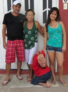 Meet the man born with his head upside-down 3