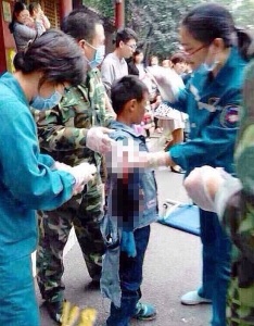 Bear in China zoo bites off nine-year-old boy's arm 4
