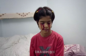 girl Cries Blood