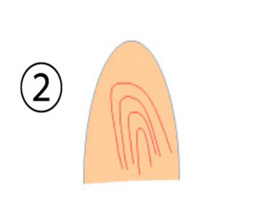 finger2