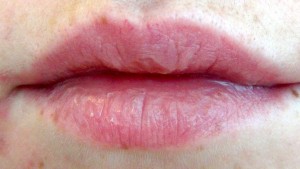 how to protect lips3