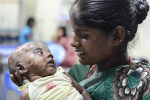 Indian parents claim their six-day-old ‘spontaneously combusted’1