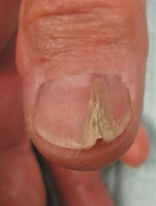 Nails Say About Your Health4