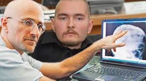 First human head transplant could happen in two years1