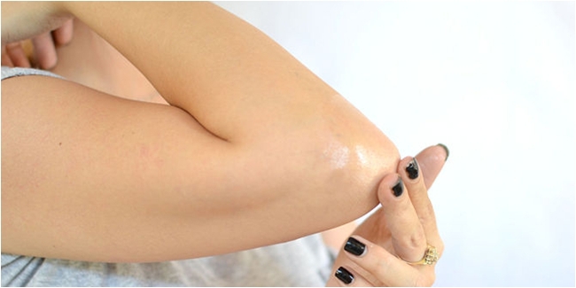How to Get Rid of Dark Elbows1