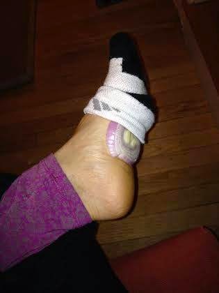 Purify blood by putting sliced up onions in your socks while you sleep3