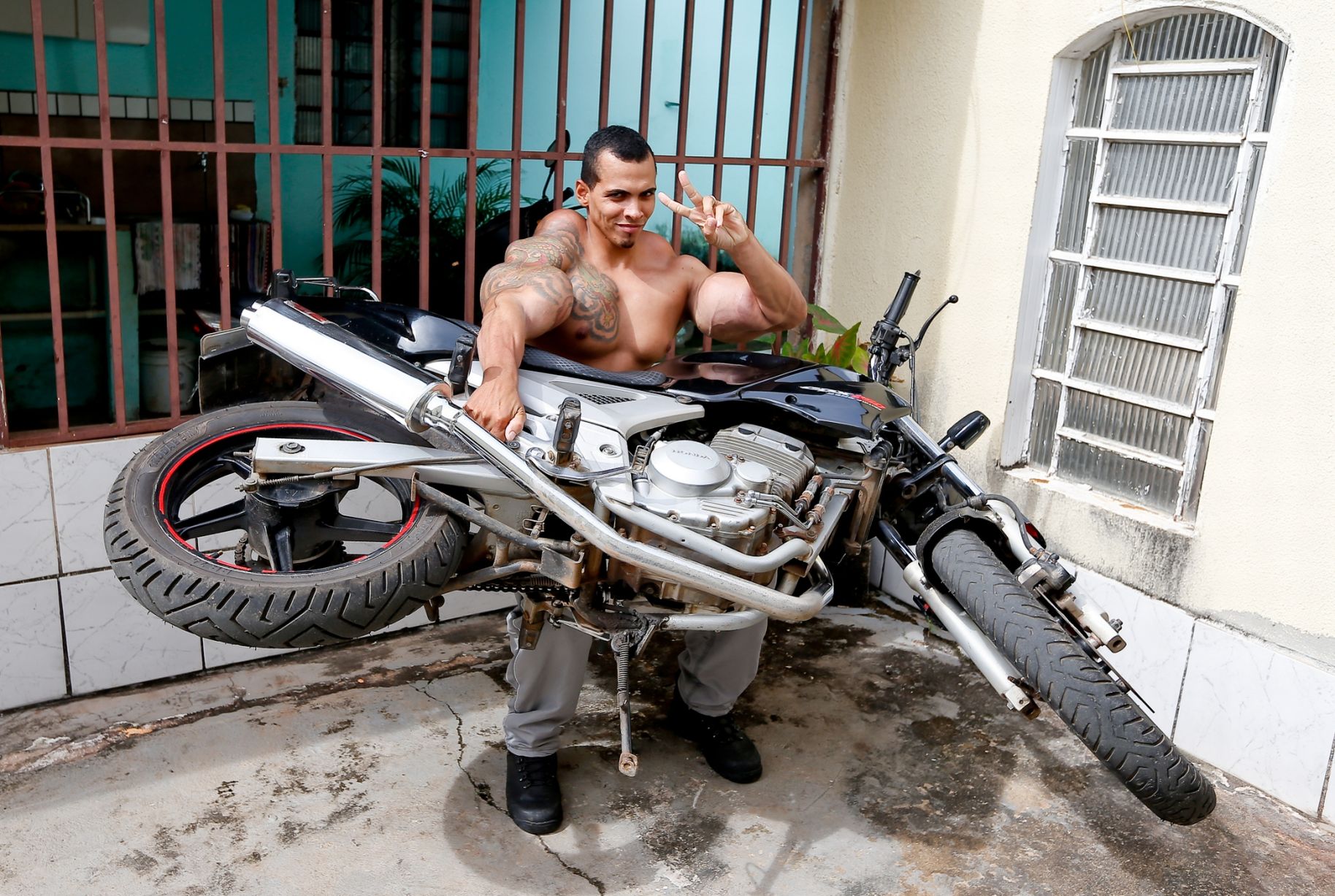 Bodybuilder almost loses arms after injecting body with oil and alcohol.