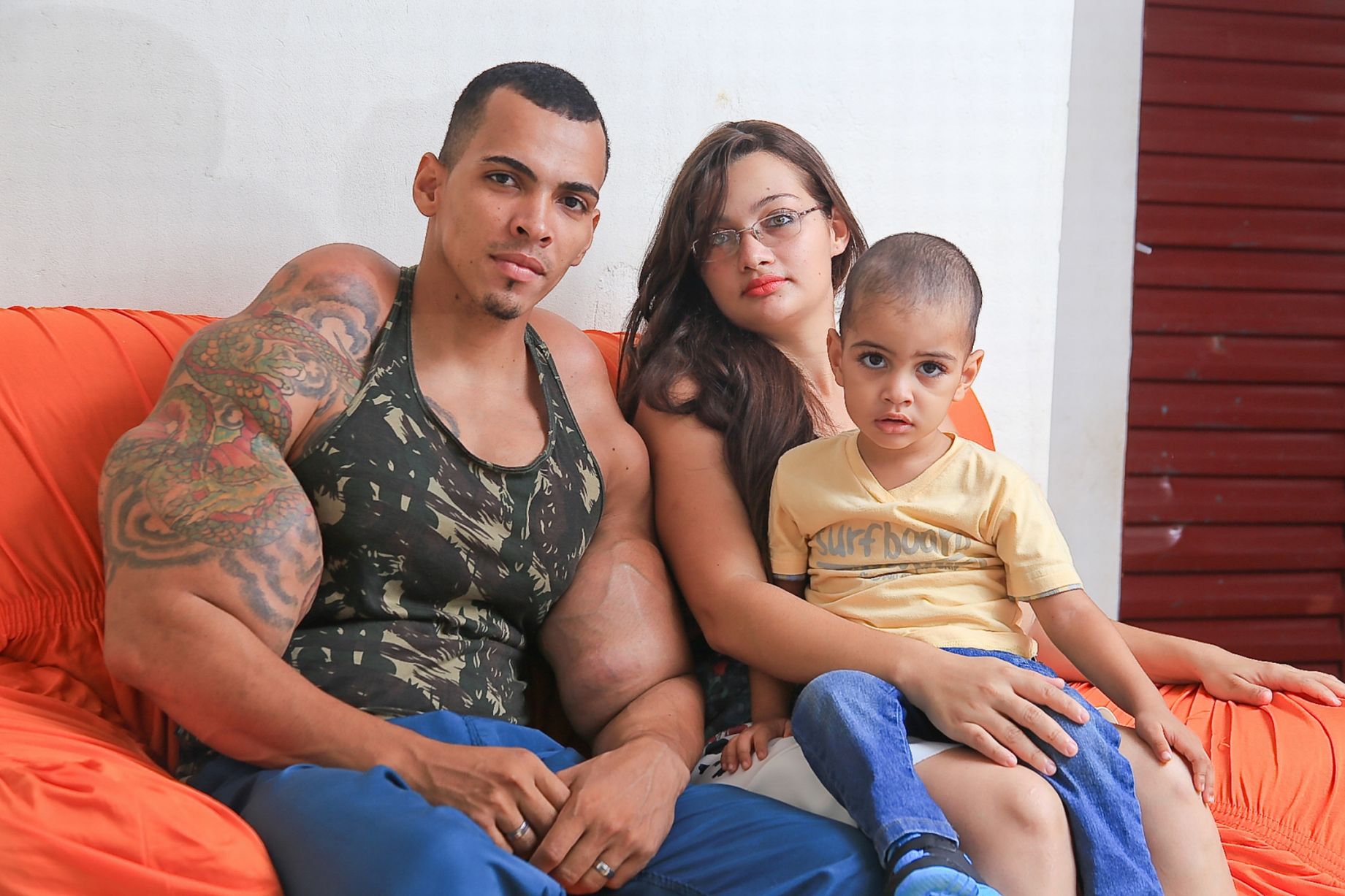 Bodybuilder almost loses arms after injecting body with oil and alcohol4
