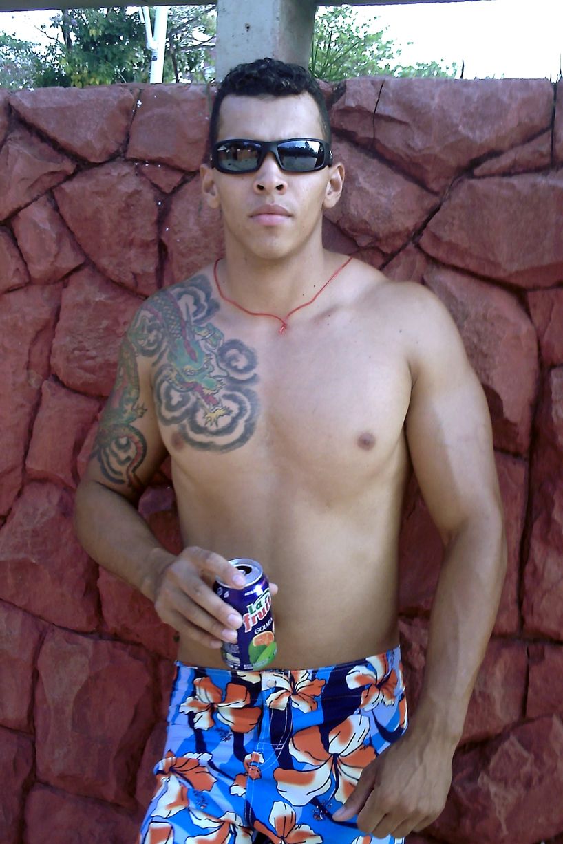 Bodybuilder almost loses arms after injecting body with oil and alcohol6