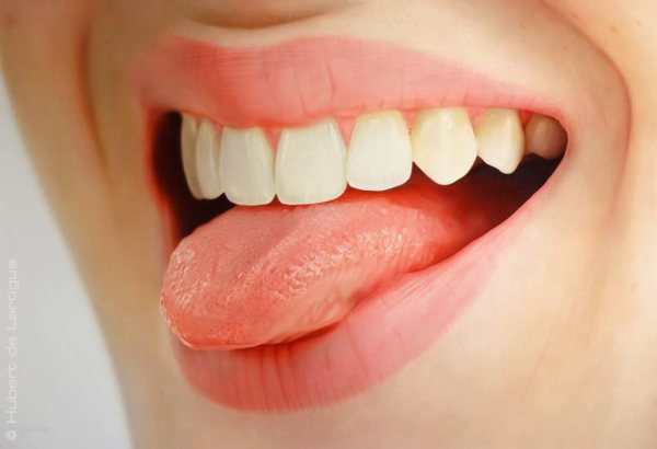 burning-tongue-home-remedies