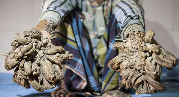 Bangladeshi-man-suffers-rare-condition-that-causes-tree-like-'roots'1