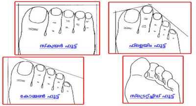 foot