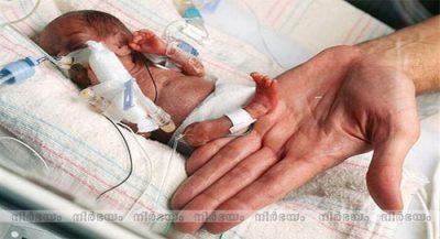 Meet-the-world's-smallest-baby-after-being-born-weighing-8-ounces (1)