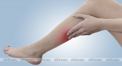 leg(1)